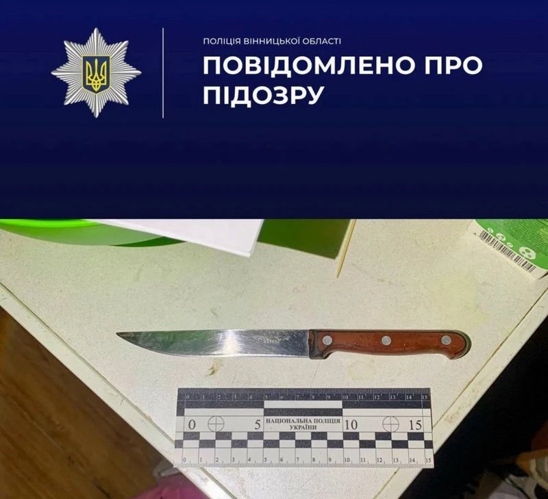 У Вінниці жінці оголосили підозру за поранення співмешканця ножем