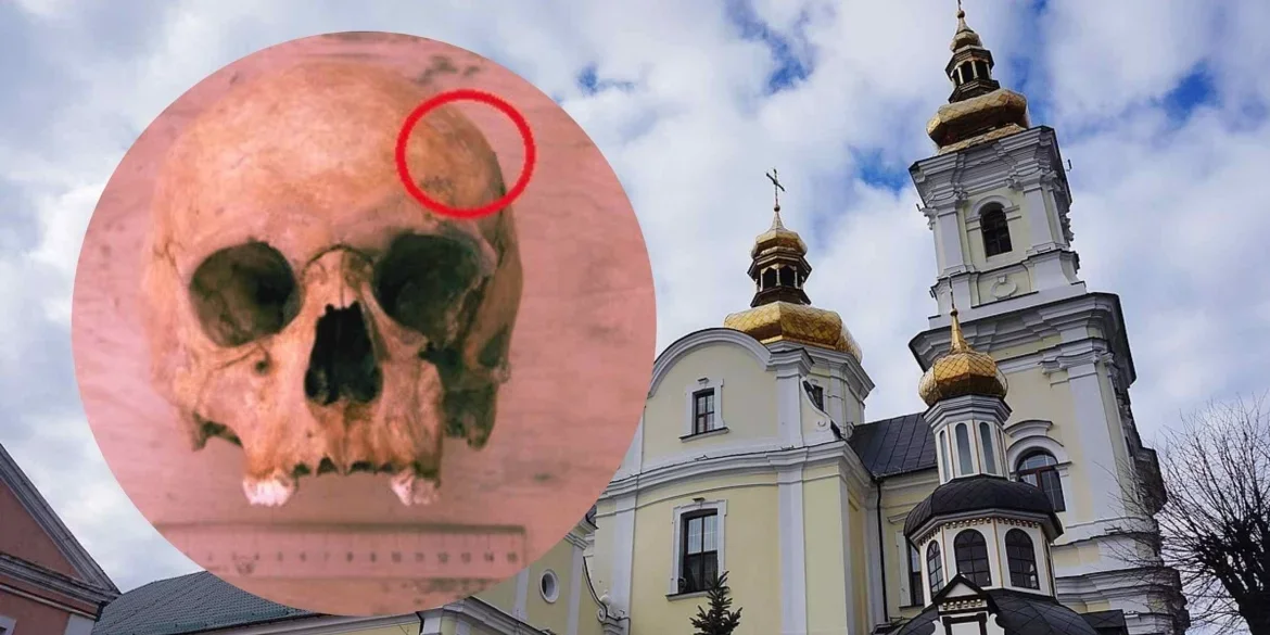 У Вінниці виявили череп зі слідами давньої трепанації на території Домініканського монастиря
