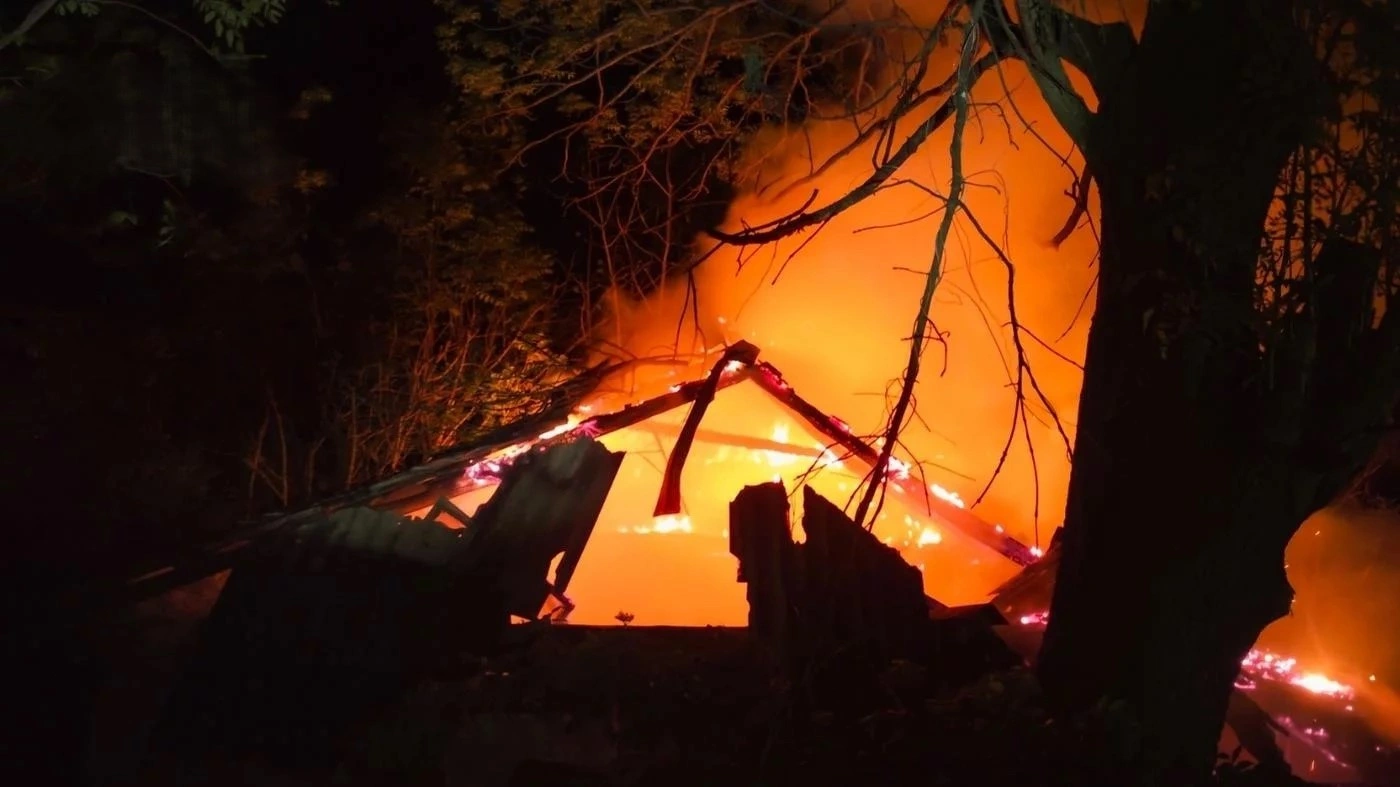 Опіки замість відпочинку: на Вінниччині необережність під час розпалювання мангалу призвела до госпіталізації